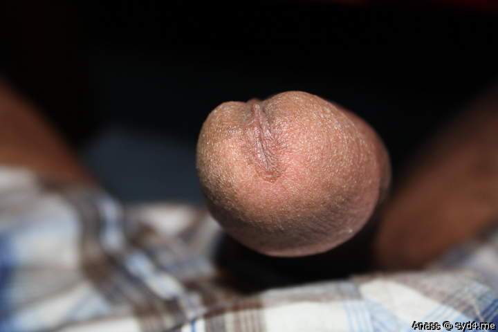 My acorn :-)