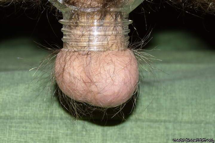 Testicles Photo from medir