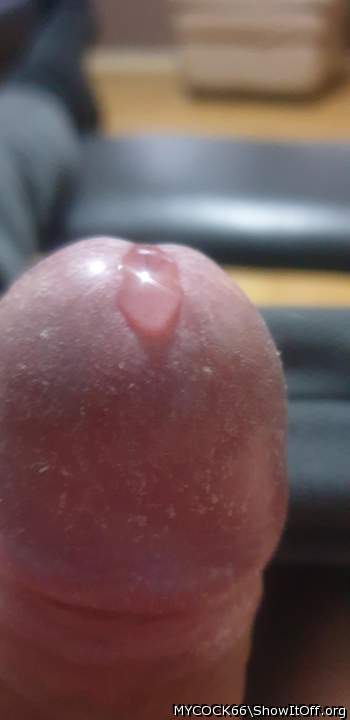 Photo of a penile from MYCOCK66