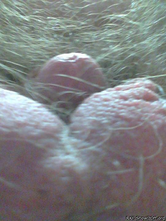 Testicles Photo from rkf