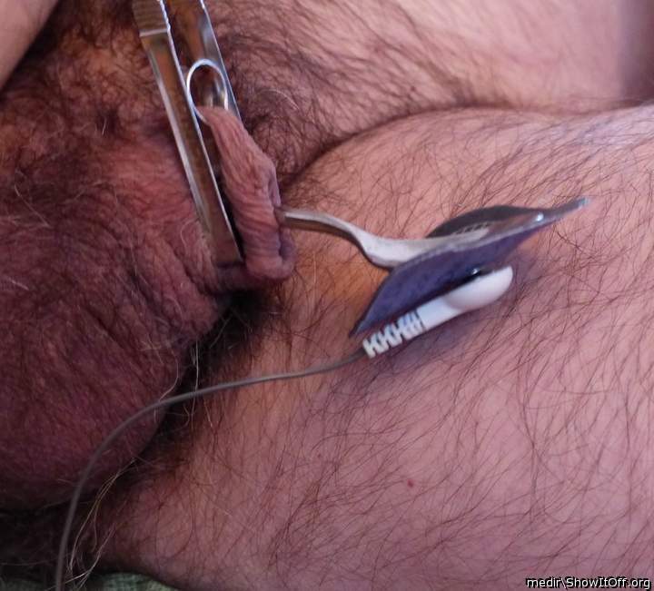  Unusual electrode  