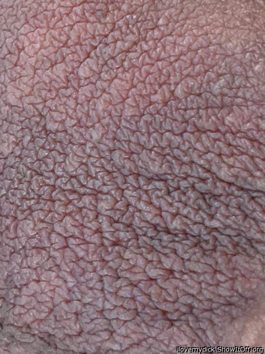 The texture of my balls 2