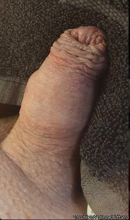 Photo of a dick from Uncutskin64