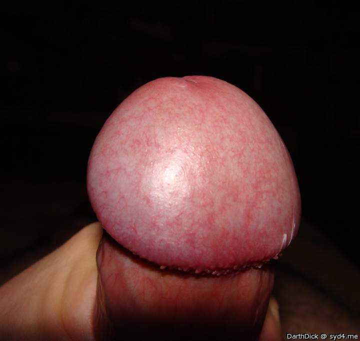 Photo of a penile from DarthDick