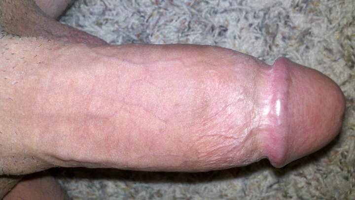 Photo of a short leg from BALLZDIXNCLITZ