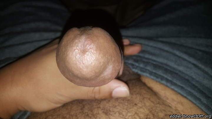 Photo of a penile from eddier