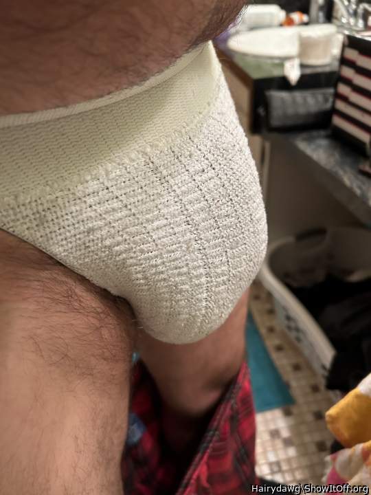 Photo of a middle leg from Hairydawg