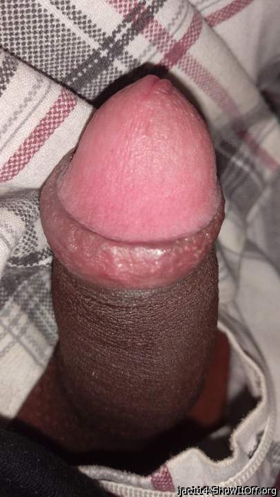 Photo of a short leg from jac114