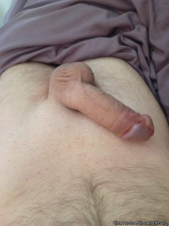 Photo of a penile from Shavenone