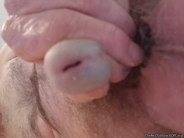 Photo of a penile from TheMrD