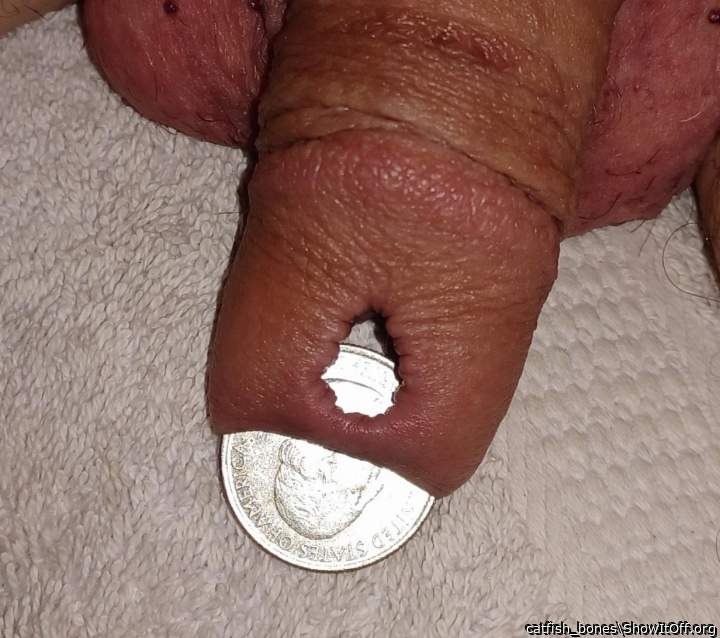 dickhead