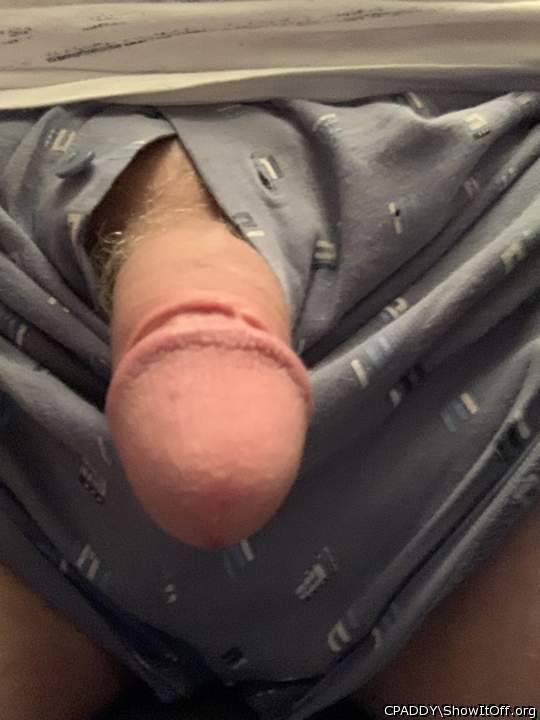 My Circumcised Dick-Do you like it?