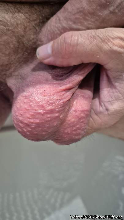 Testicles Photo from Nottm1968