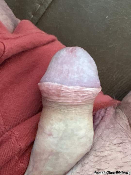 Photo of a prick from Uncutdi