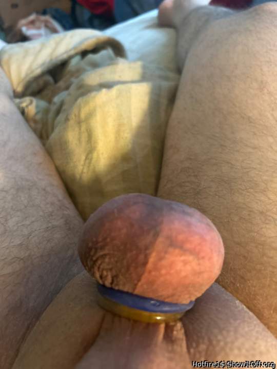 Testicles Photo from Hotfire1$
