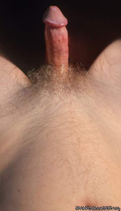 Photo of a penis from JPHARD