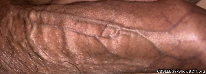 Veins Right Side 1