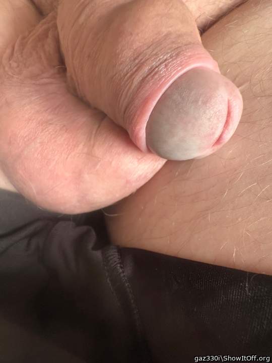 My penis
