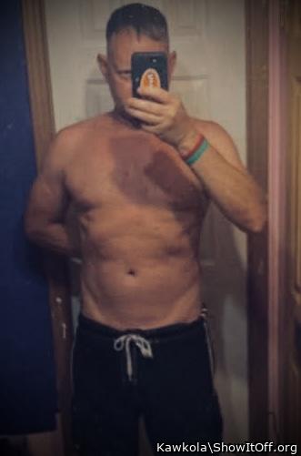 My body