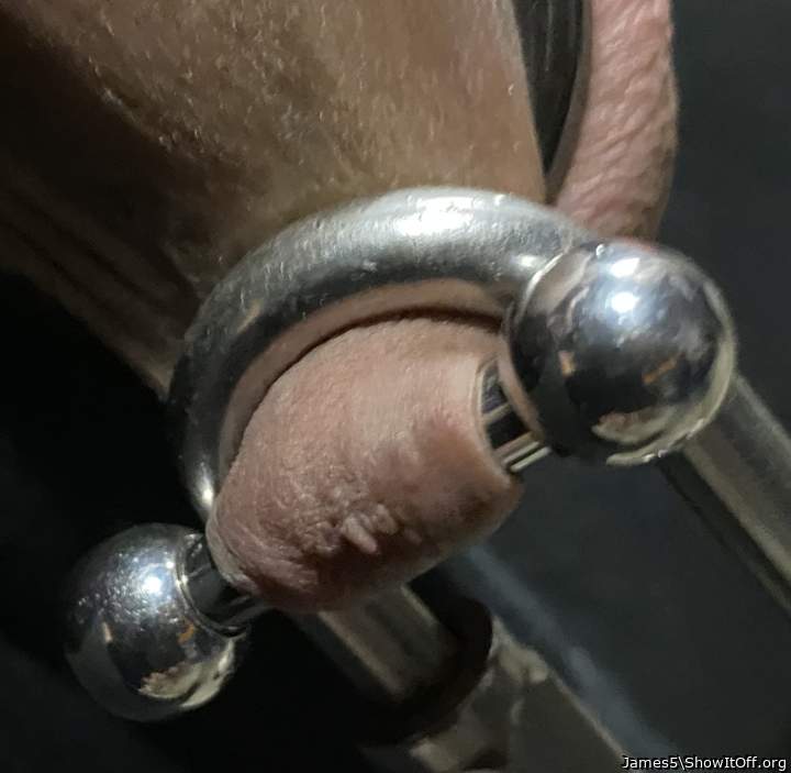 Weight on frenum