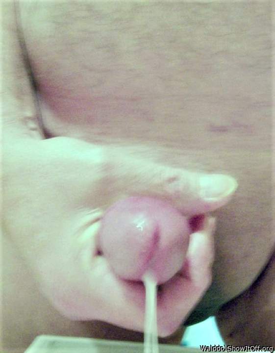 Photo of a private part from Walddo