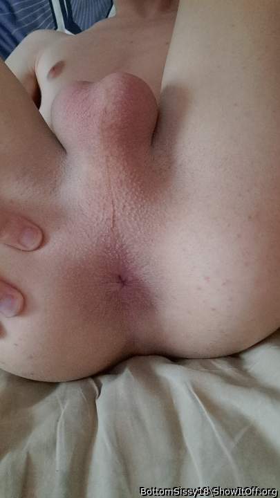 xxx