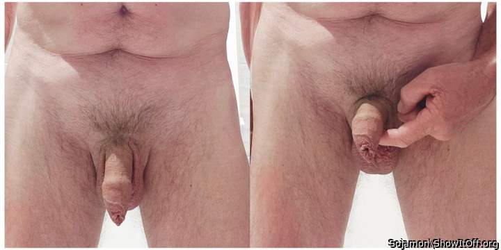 My foreskin