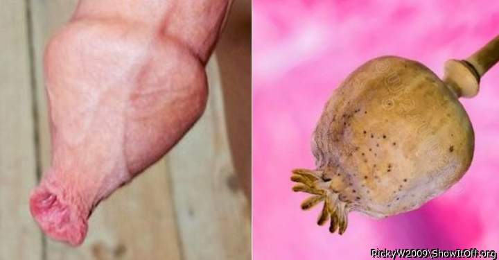 Perfect foreskin snout versus poppy seed head