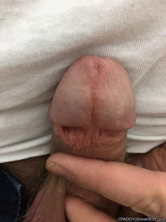 My Circumcised Dick-Do you like it?