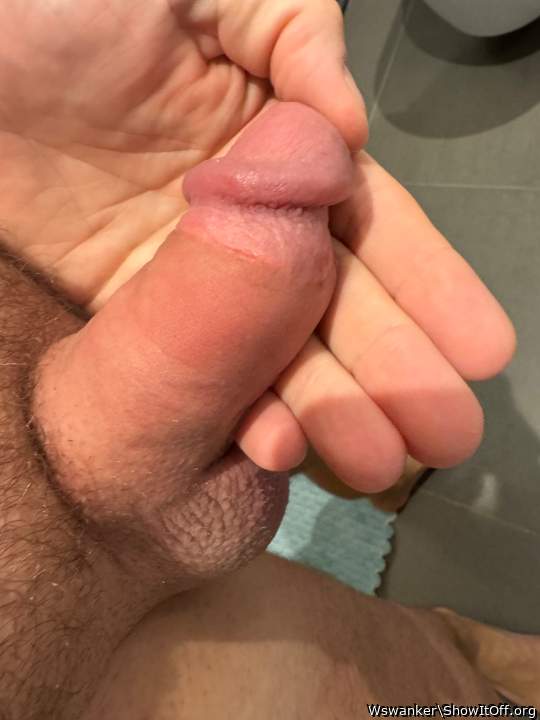 Swollen cock from a wasp sting whilst outside naked, swelled up nicely