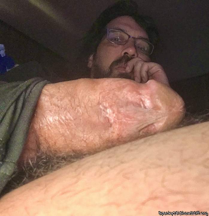 Photo of a middle leg from Spanky18