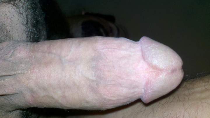 Photo of a penile from BALLZDIXNCLITZ