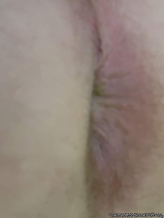 Photo of a penile from towman812