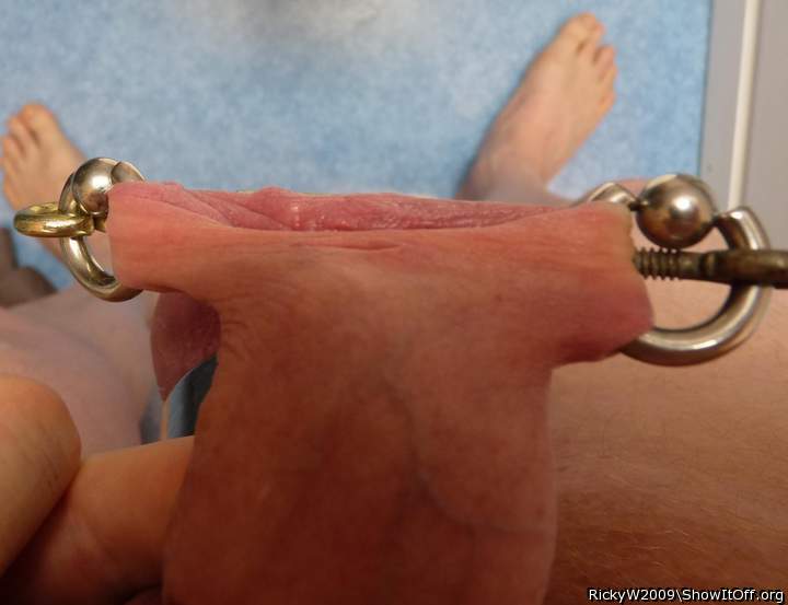 Stretched foreskin