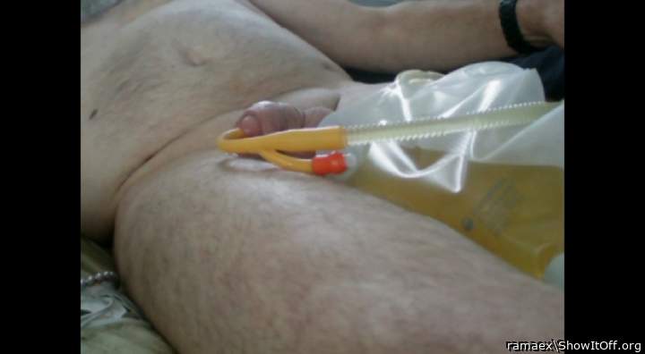Catheter and legbag