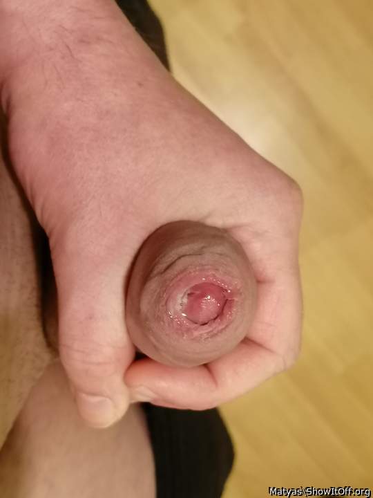 Photo of a penile from Matyas