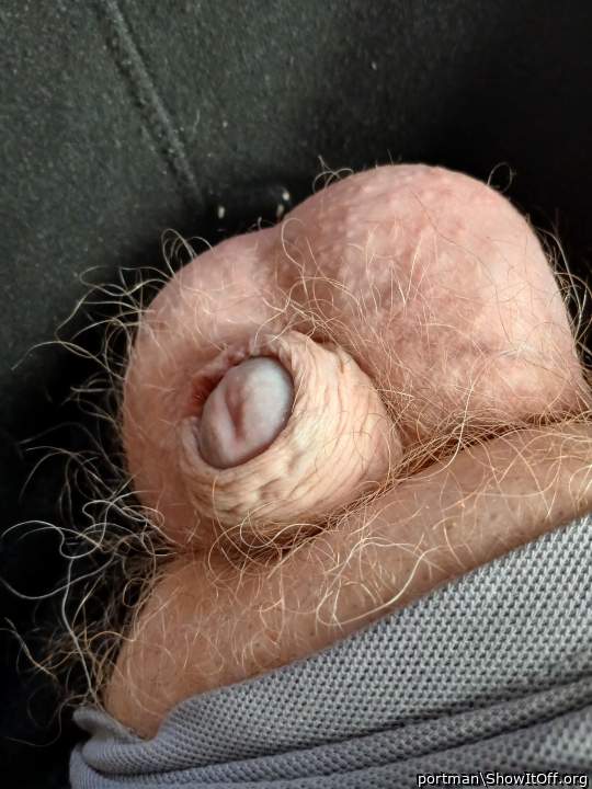 Hairy balls