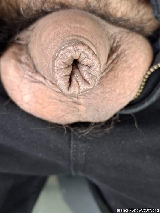 Photo of a middle leg from alanck