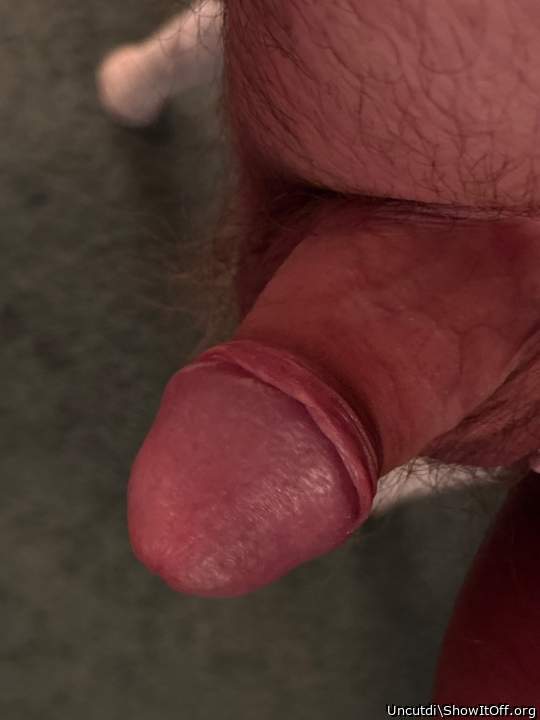 Photo of a penile from Uncutdi