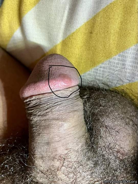 Any idea what this spot on my head is? Its hard flat spot.