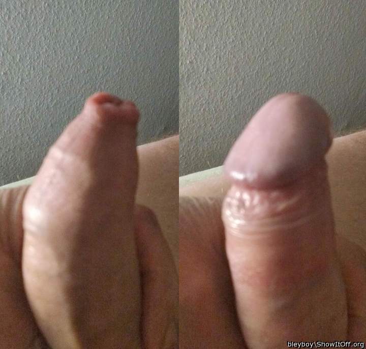 FUcking hot! Amazing foreskin!   I have a pic like that too!