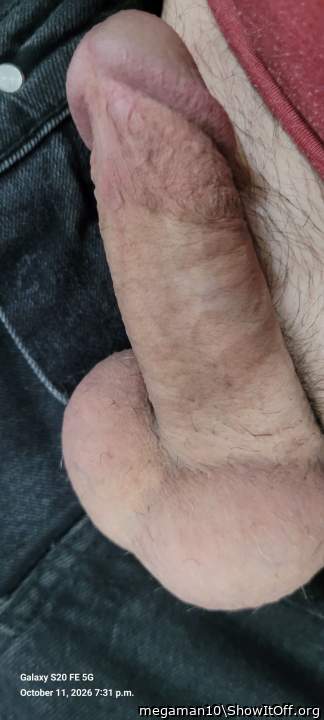 Photo of a middle leg from megaman10