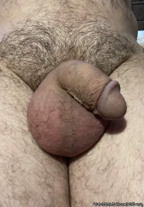Photo of a penile from Watchthis2