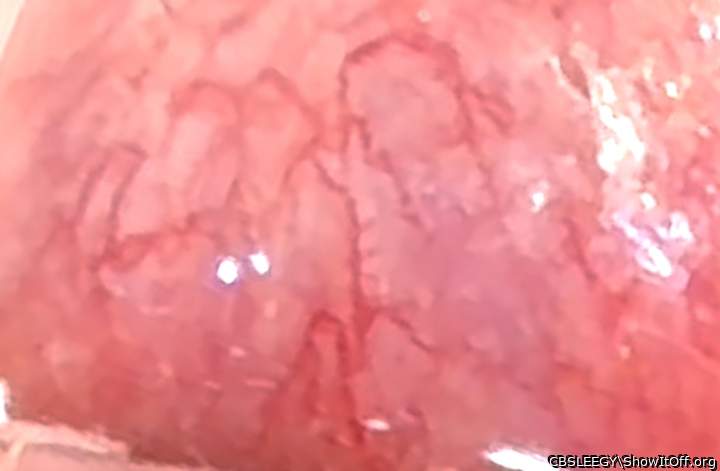 Veins inside my Uretha!