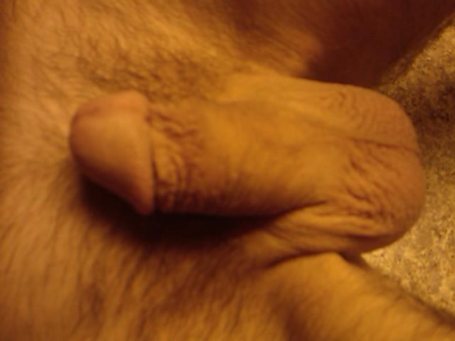 Photo of a penile from yardog319
