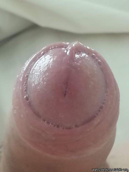 Photo of a penis from we3236