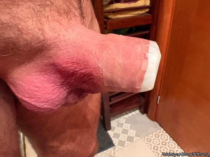 T tape dry shampoo lid