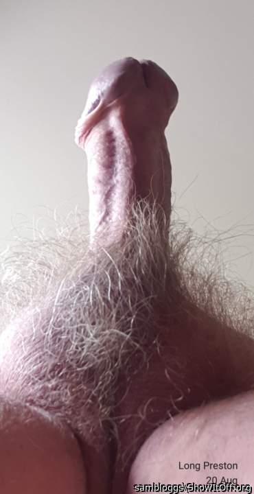 Photo of a penis from sambloggs