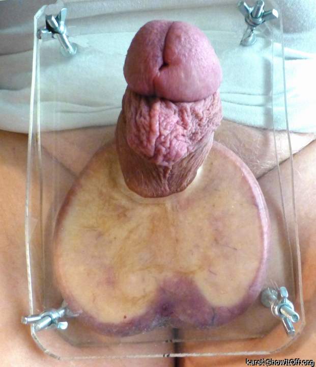 Ouch but I like the view