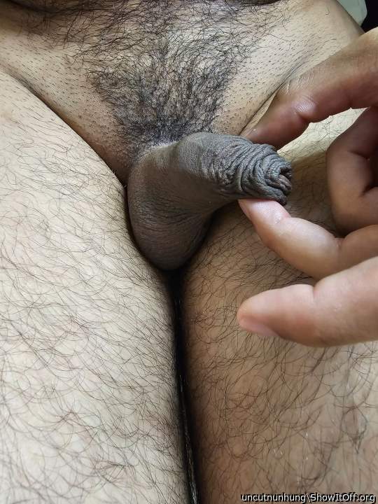 Photo of a penis from uncutnunhung